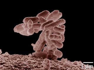 Escherichia coli, grossissement × 10 000
