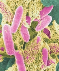 Des bactéries Escherichia coli (en rose)